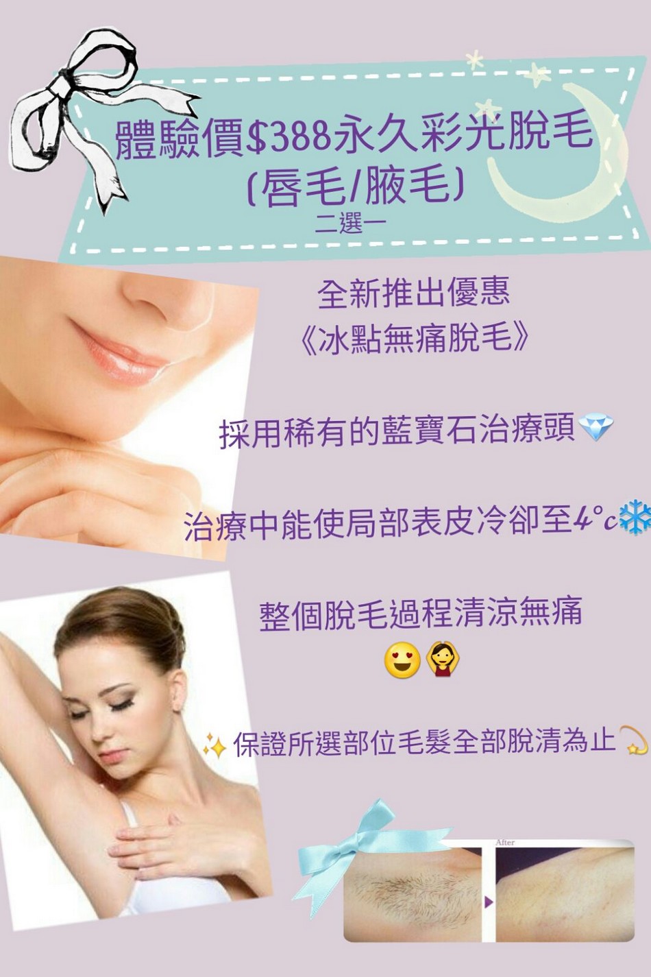 http://www.lavenderbeautyhk.com/files/20170312-_388%E6%B0%B8%E4%B9%85%E5%BD%A9%E5%85%89%E8%84%AB%E6%AF%9B.jpg